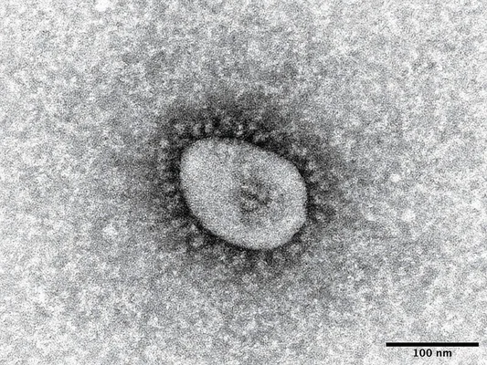 コロナ後遺症がもたらす子どもへの影響とは