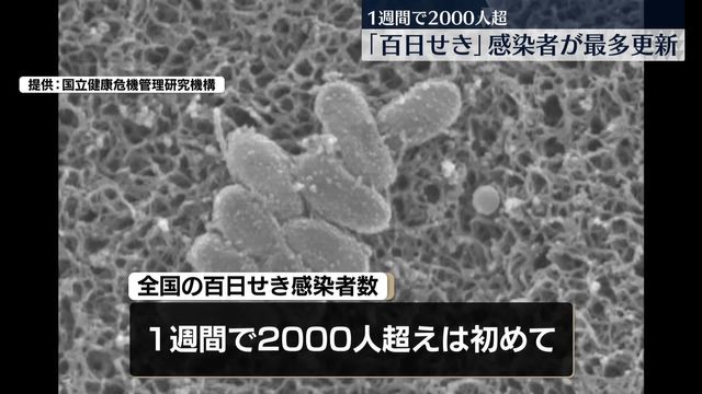 百日せき感染者数が初めて2000人超え