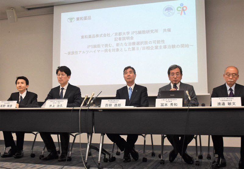 家族性アルツハイマー病の最終治験開始 | 京都大の新たな挑戦